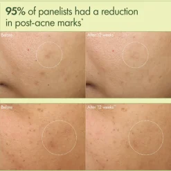 Dr Weil Mega-Mushroom Dark Spot Corrector Moisturizer