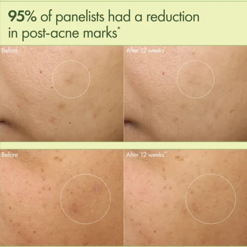 Dr Weil Mega-Mushroom Dark Spot Corrector Moisturizer